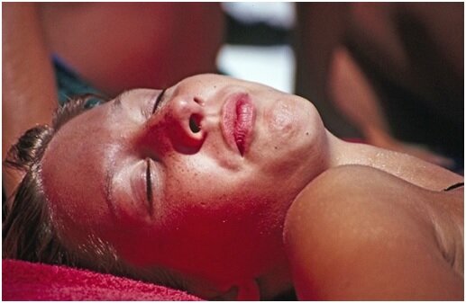 How to Treat a Sunburn